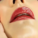 Misecretonet