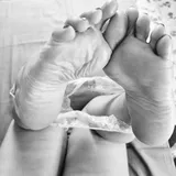 Hot feet